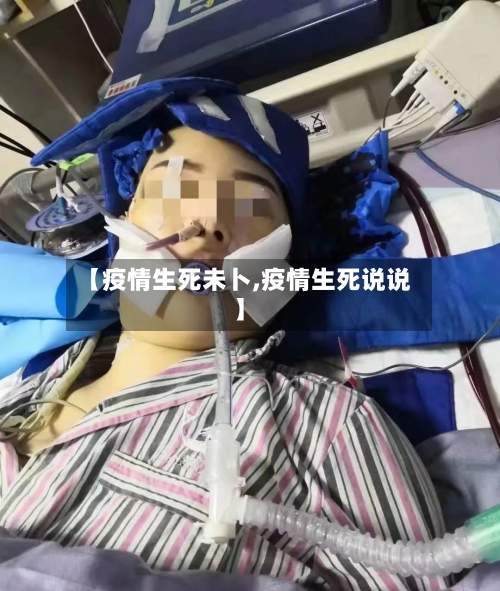 【疫情生死未卜,疫情生死说说】-第2张图片