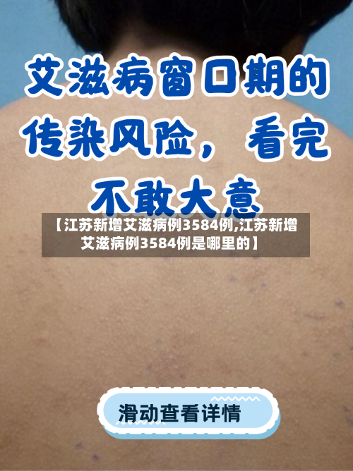 【江苏新增艾滋病例3584例,江苏新增艾滋病例3584例是哪里的】-第2张图片