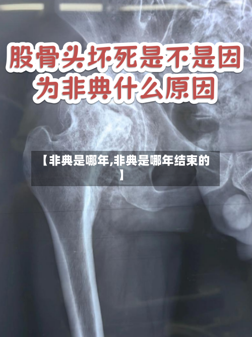 【非典是哪年,非典是哪年结束的】